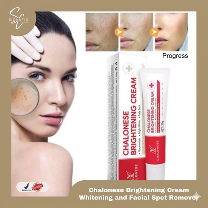 Buy 1 Get 1 Free - Chalonese Brightening Cream